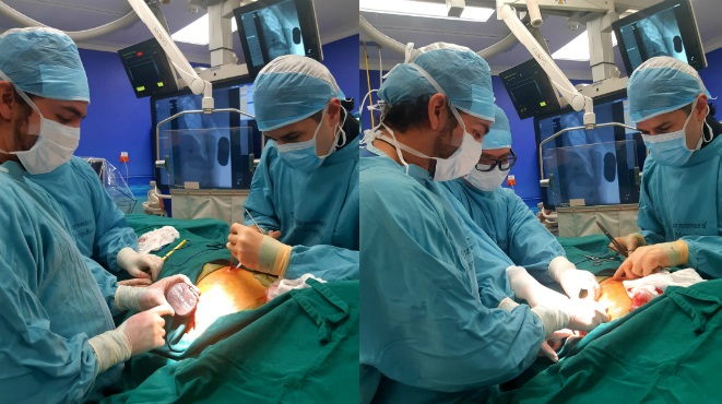 Implante de cardiodesfibrilador subcutneo en el Hospital Metropolitano.