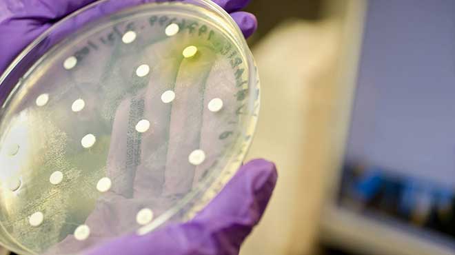 El SAAP-148 elimina las bacterias que crecen en biopelculas de cultivo