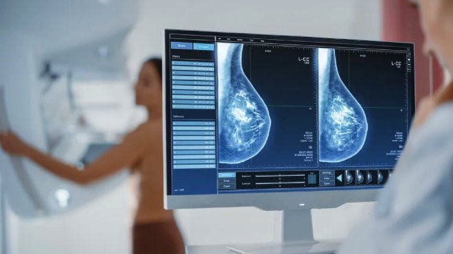La mamograf�a es pieza importante para la detecci�n oportuna del c�ncer de mama.