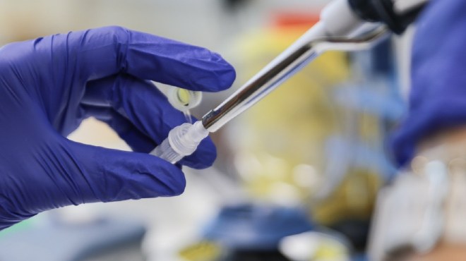 Est�n actualizadas las orientaciones sobre pruebas diagn�sticas para detectar la nueva cepa del virus.